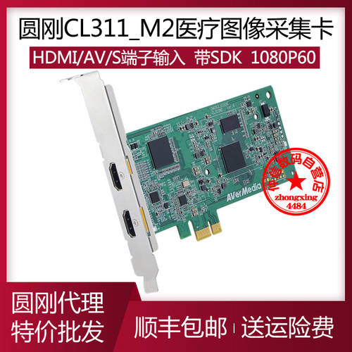 AVERMEDIA CL311-M2 고선명 HD 캡처카드 HDMI 영상 회의 1080P60 의료 색깔 B SUPER 내시경 영상